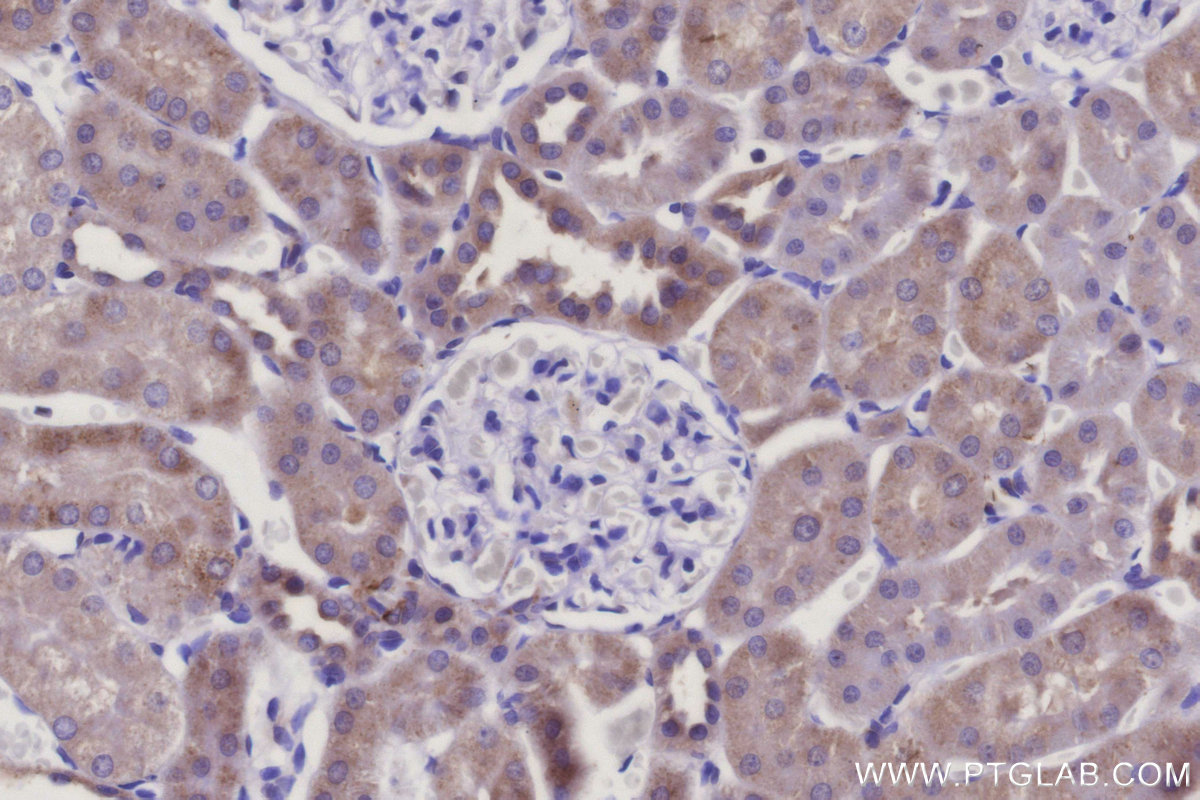 IHC staining of rat kidney using 16301-1-AP IHC staining of rat kidney using 16301-1-AP