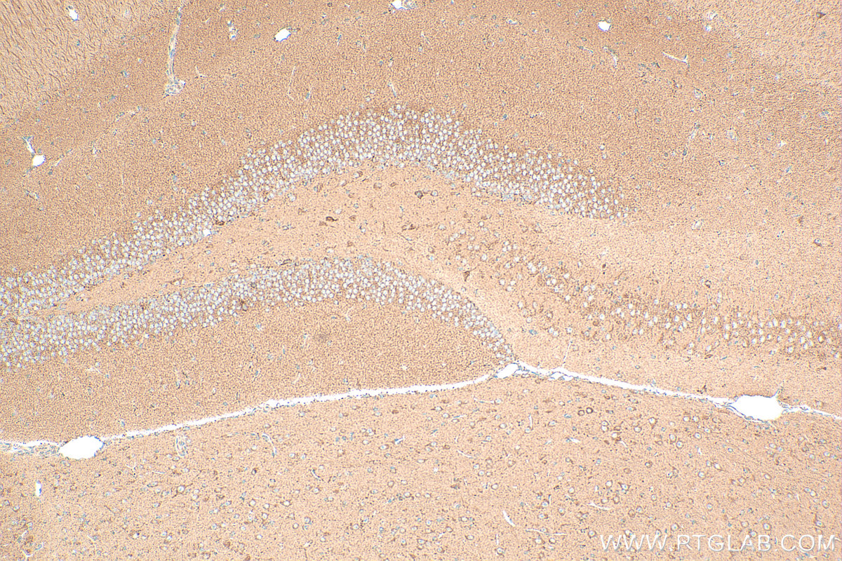 IHC staining of mouse brain using 16735-1-AP