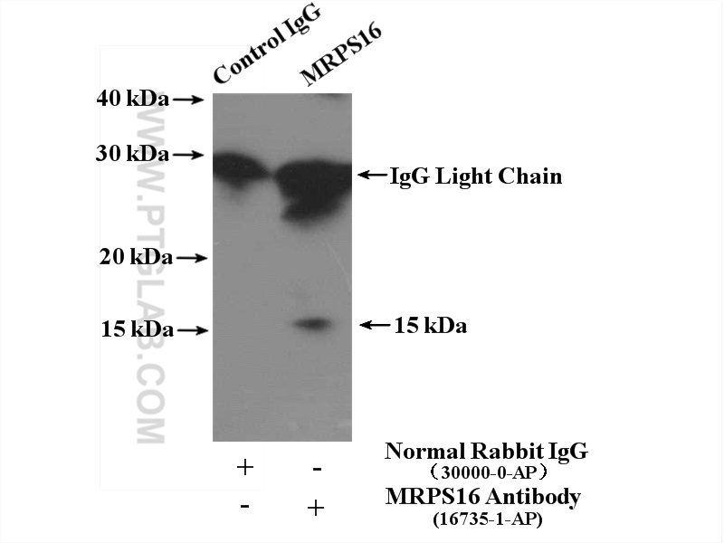 IP experiment of HEK-293 using 16735-1-AP