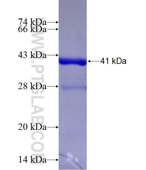 MRPS17 fusion protein Ag13419 SDS-PAGE MRPS17 fusion protein Ag13419 SDS-PAGE