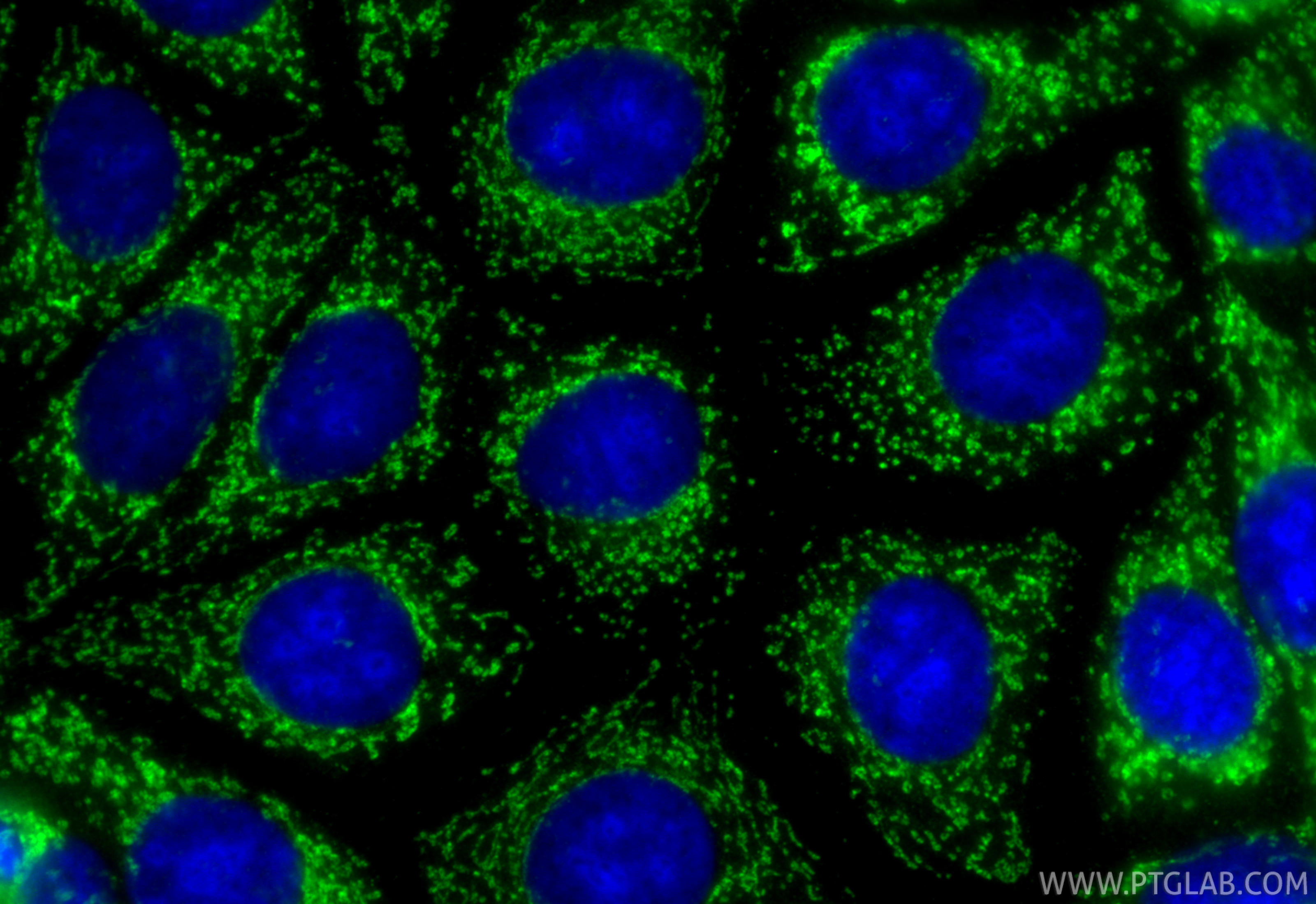 IF Staining of MCF-7 using 10984-1-AP IF Staining of MCF-7 using 10984-1-AP