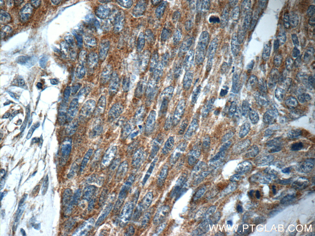 MRPS26 Polyclonal antibody