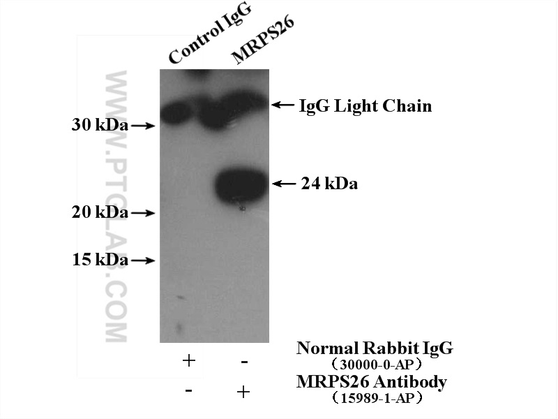 IP experiment of HepG2 using 15989-1-AP