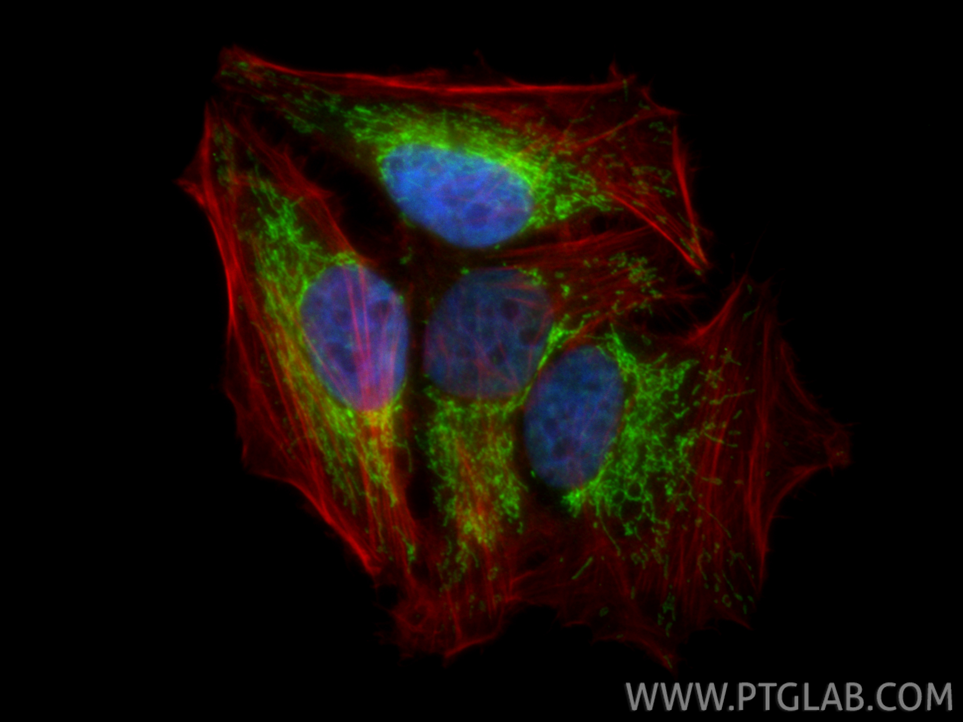 IF Staining of HepG2 using 17280-1-AP
