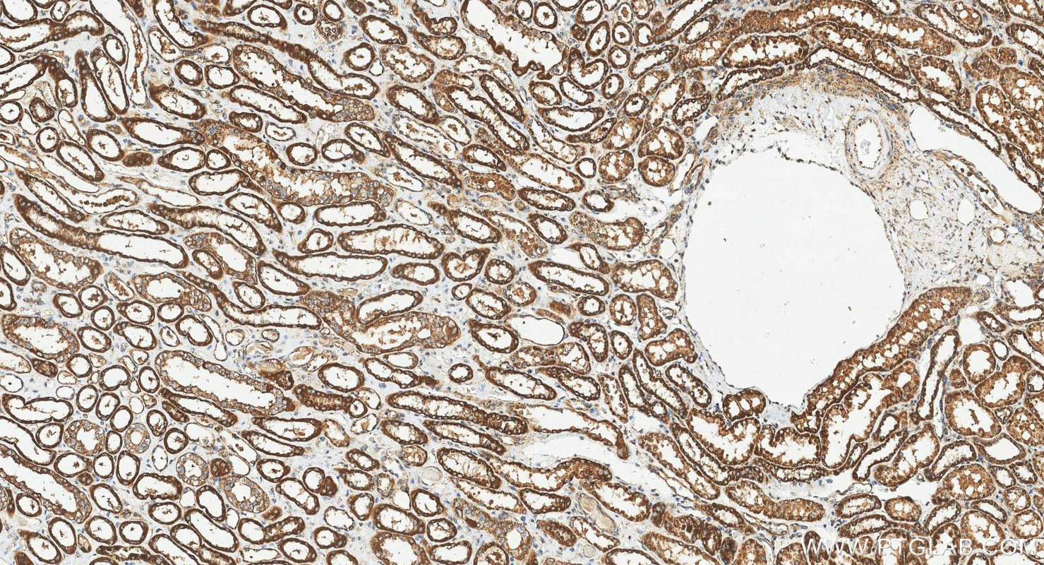 IHC staining of human kidney using 17280-1-AP IHC staining of human kidney using 17280-1-AP