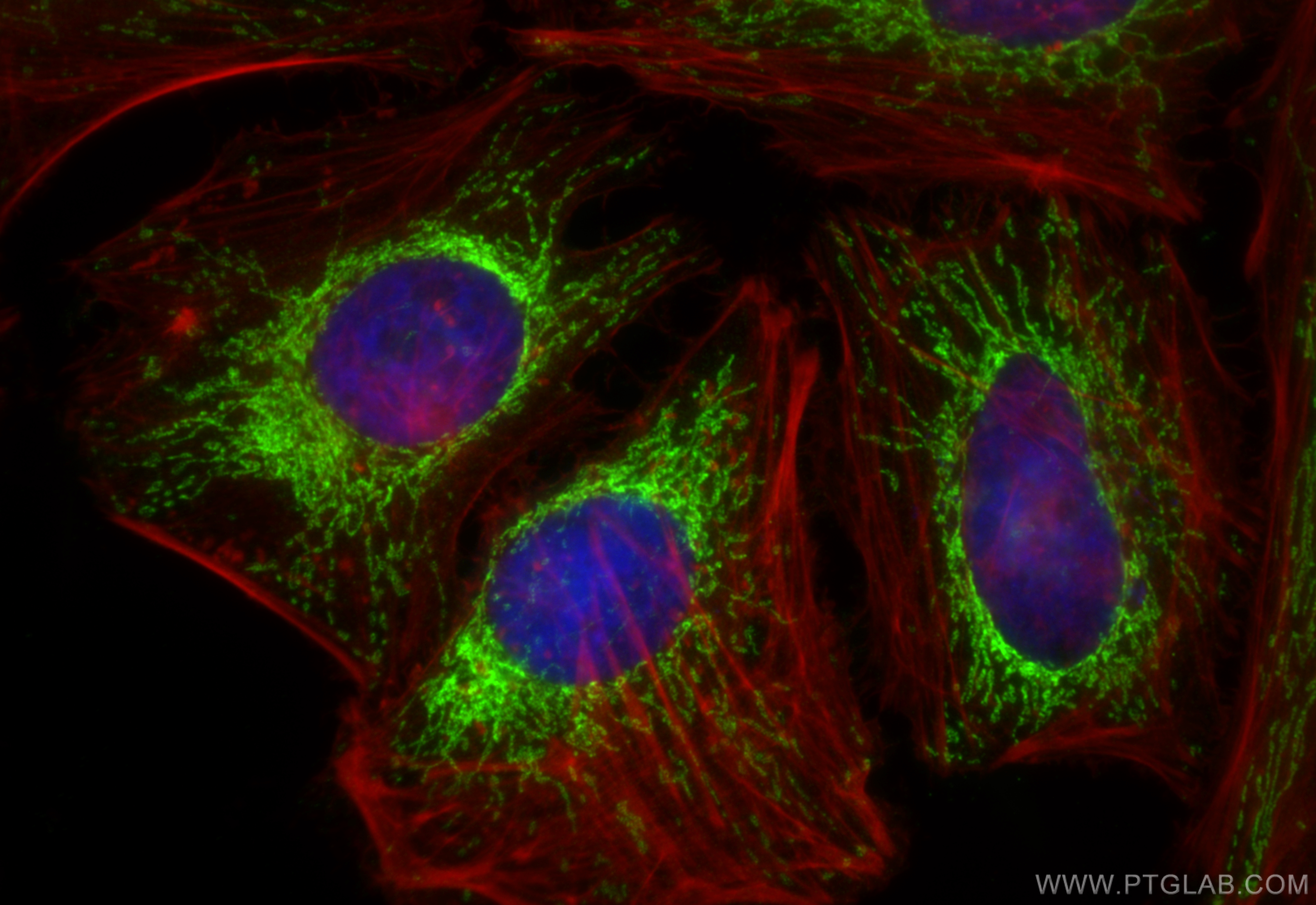 IF Staining of HeLa using 16378-1-AP