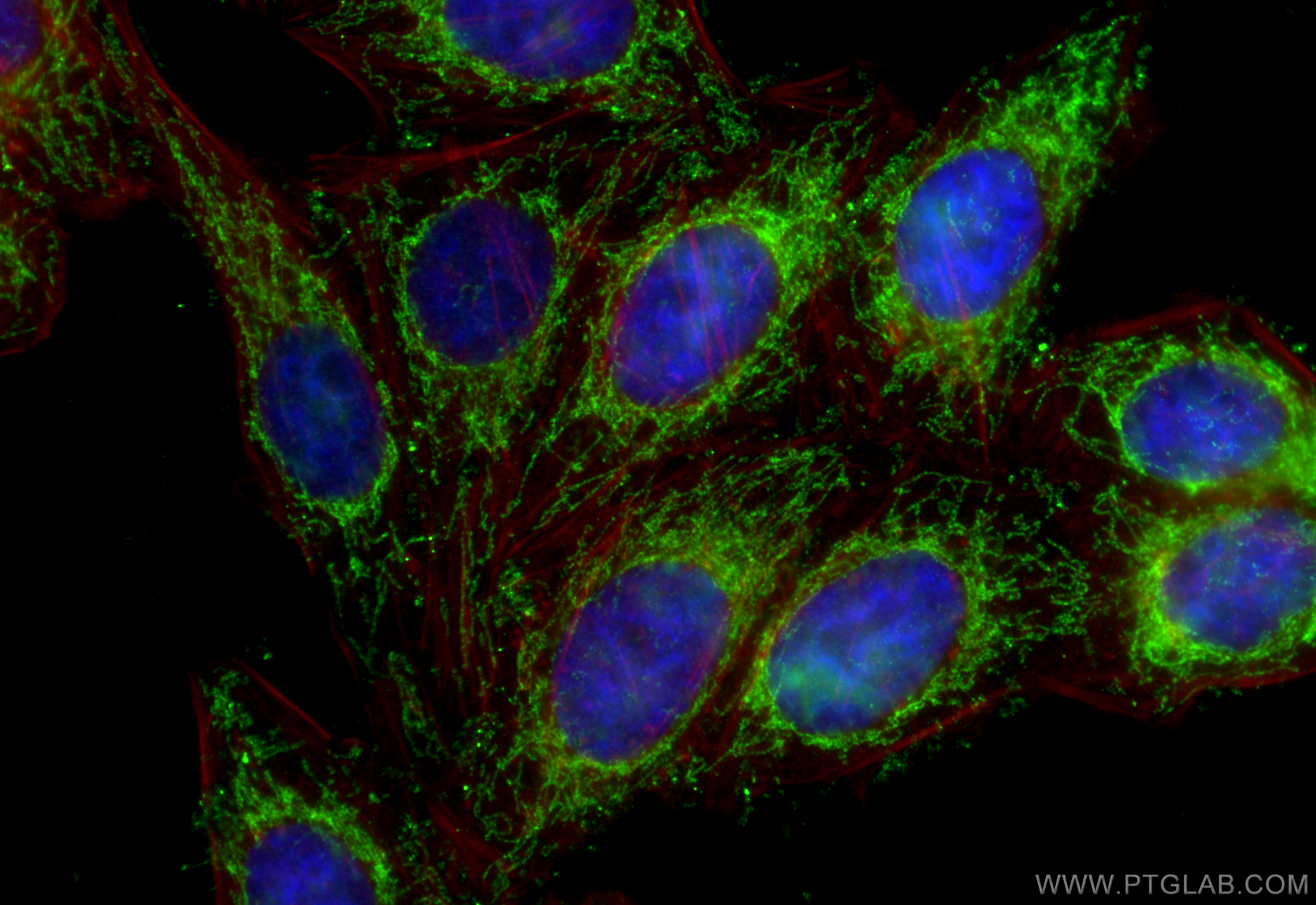 IF Staining of HepG2 using 16279-1-AP