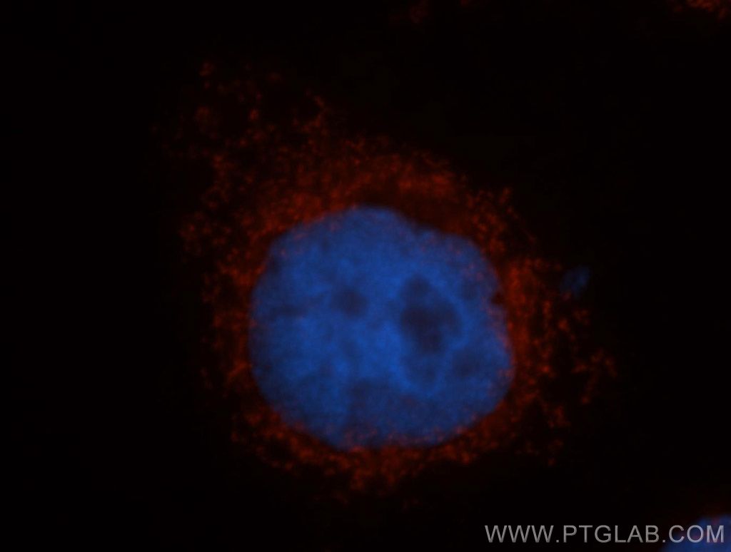 IF Staining of MCF-7 using 12357-2-AP