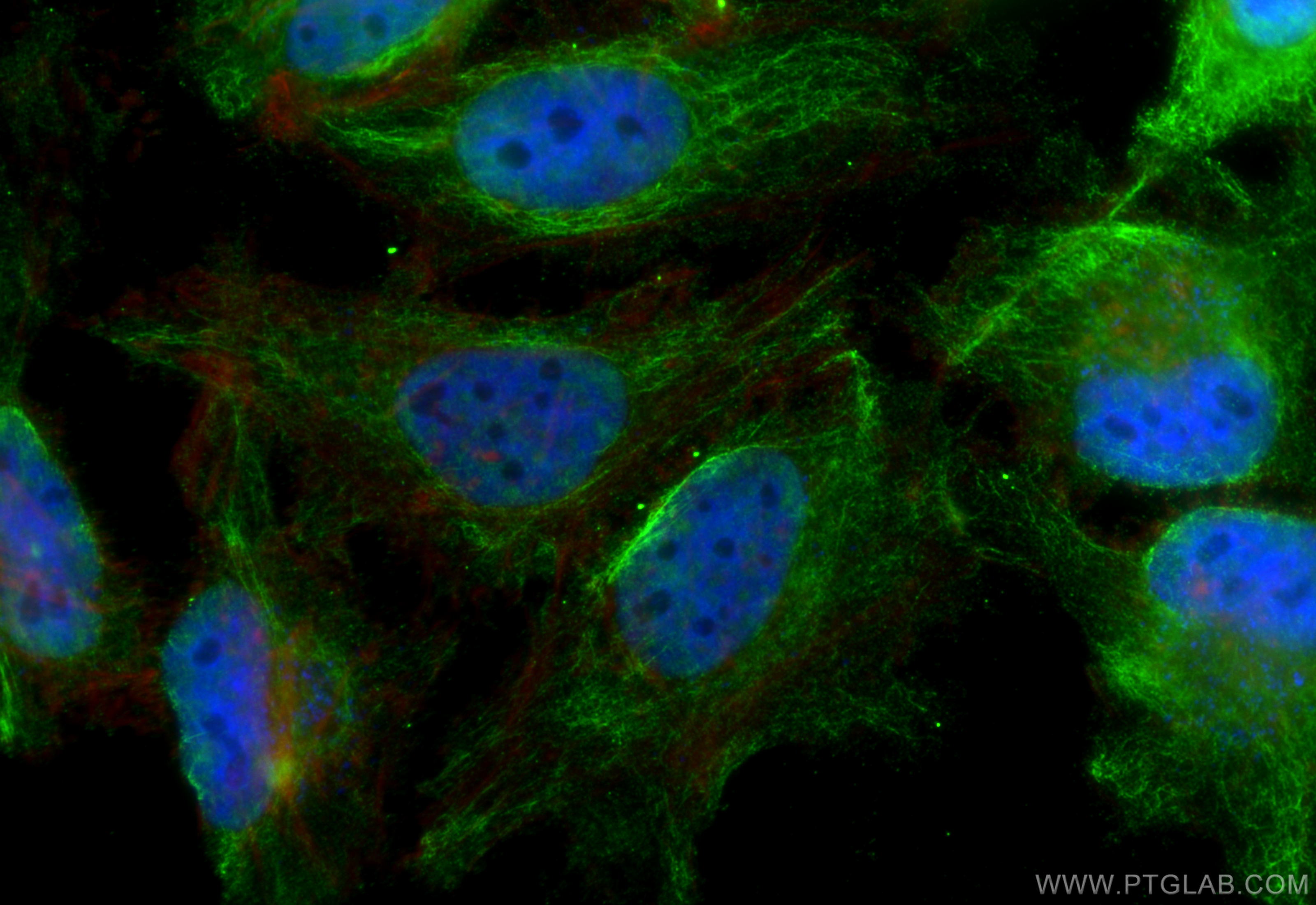 IF Staining of HeLa using 66942-1-Ig (same clone as 66942-1-PBS)