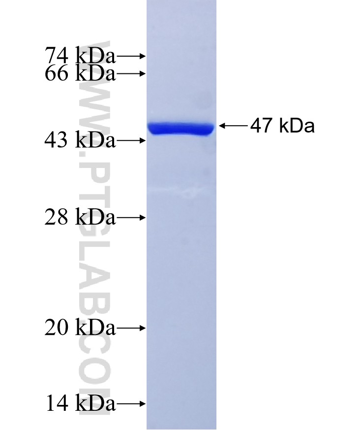 MRS2 fusion protein Ag36607 SDS-PAGE MRS2 fusion protein Ag36607 SDS-PAGE