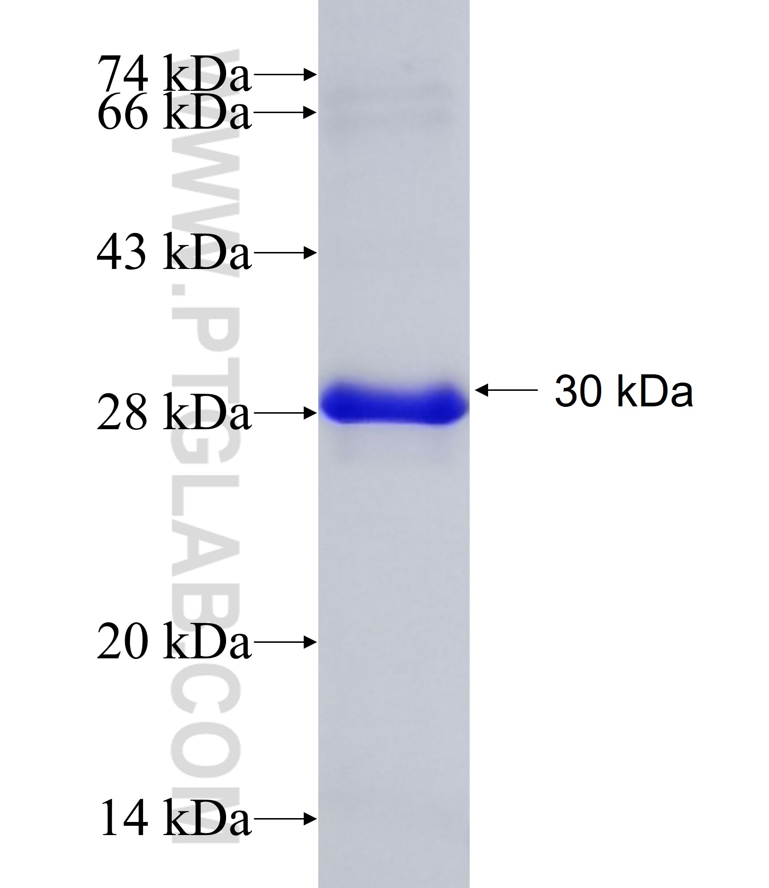 MRTFB fusion protein Ag34719 SDS-PAGE MRTFB fusion protein Ag34719 SDS-PAGE