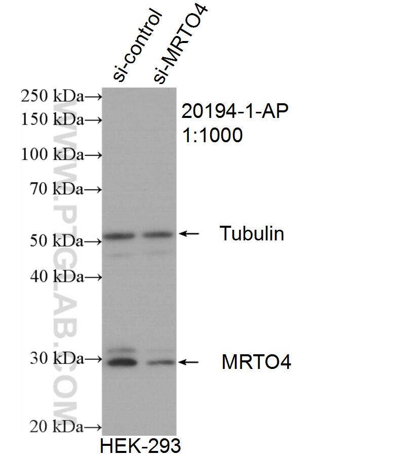 WB analysis of HEK-293 using 20194-1-AP (same clone as 20194-1-PBS)