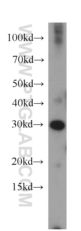 WB analysis of human skeletal muscle using 20194-1-AP (same clone as 20194-1-PBS)