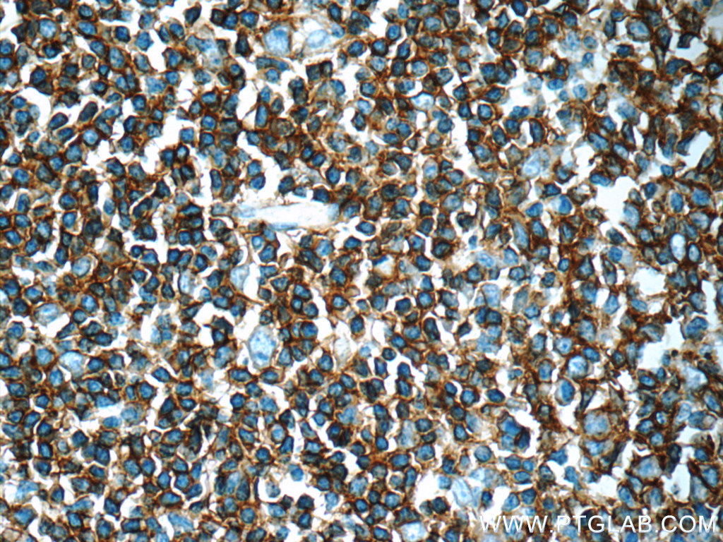 CD20 Polyclonal antibody