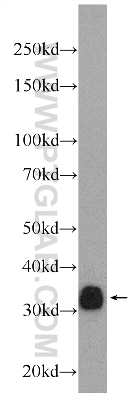 CD20 Polyclonal antibody