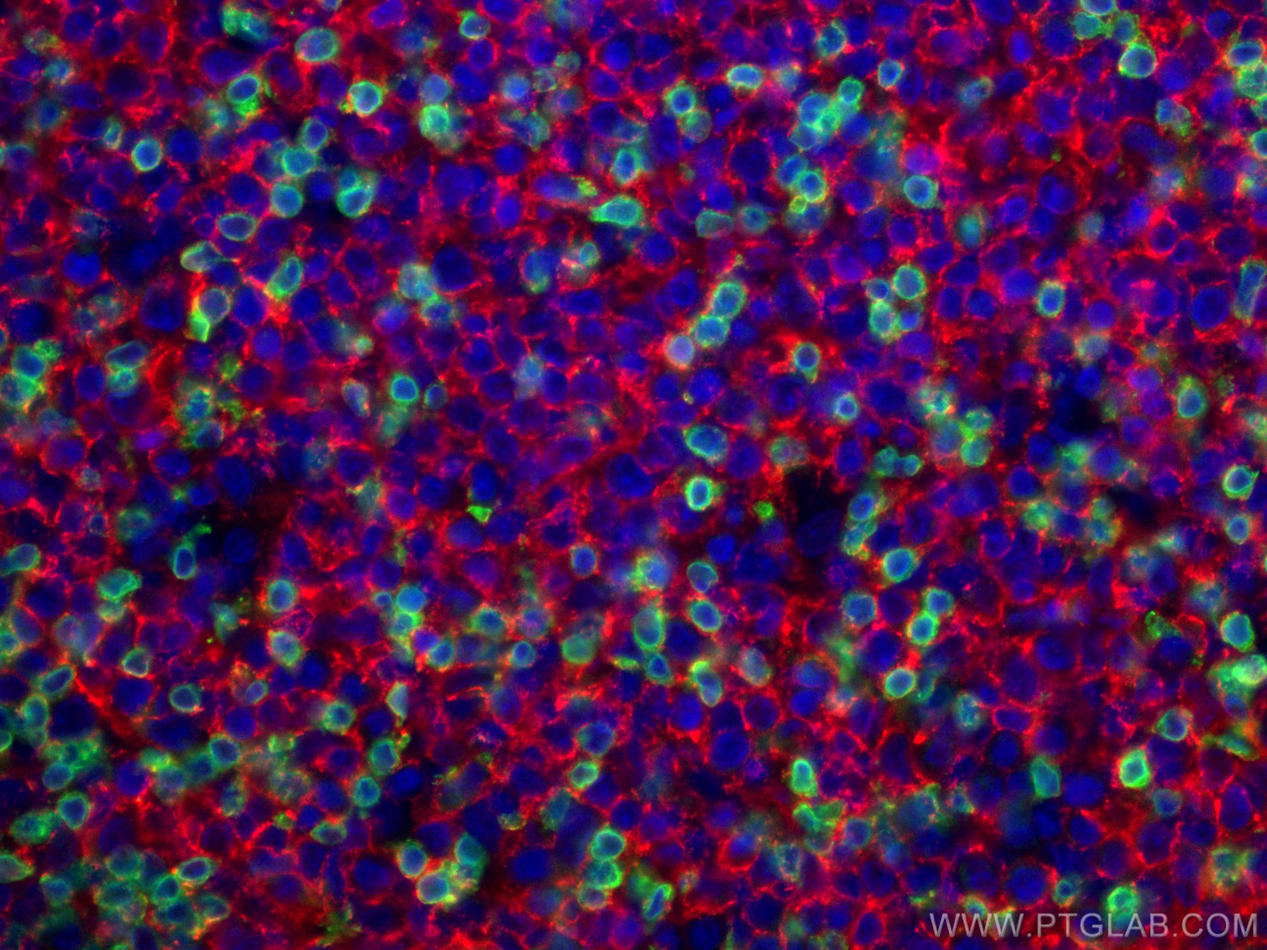 IF Staining of human tonsillitis using 60271-1-Ig (same clone as 60271-1-PBS)