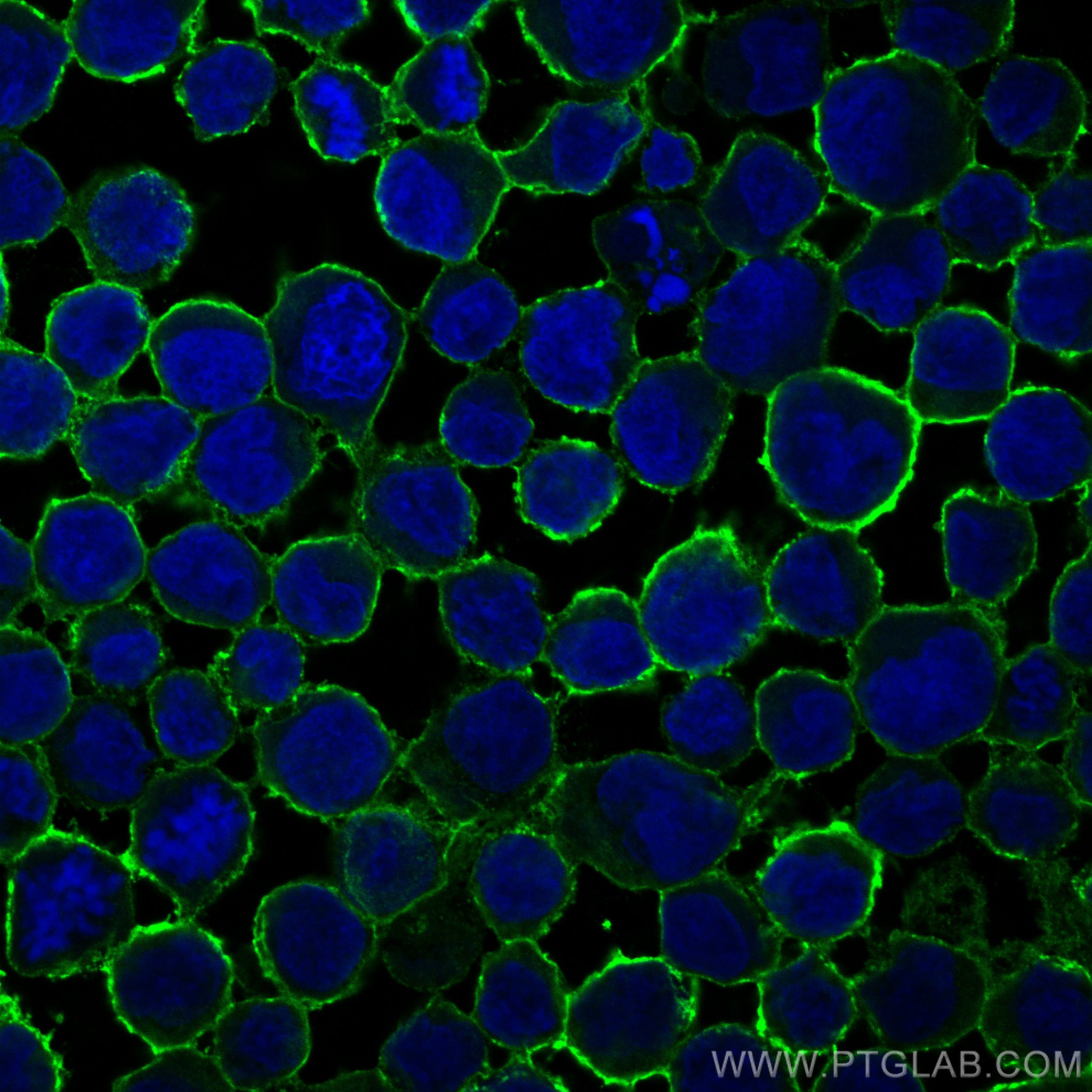 IF Staining of Raji using 60271-1-Ig
