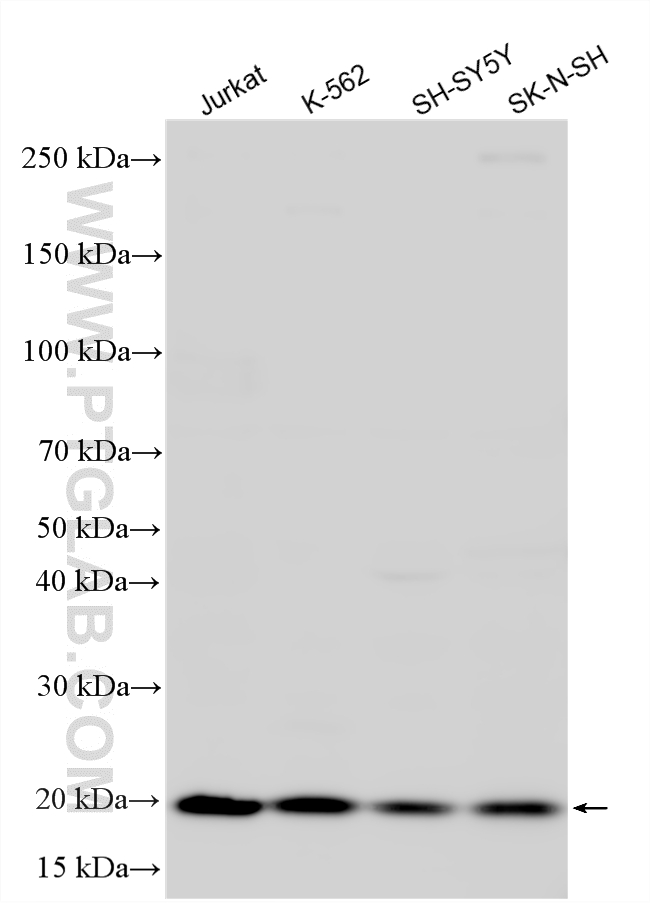 WB analysis using 11930-1-AP WB analysis using 11930-1-AP