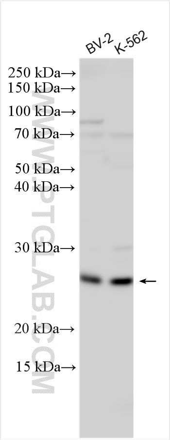 WB analysis using 11864-1-AP