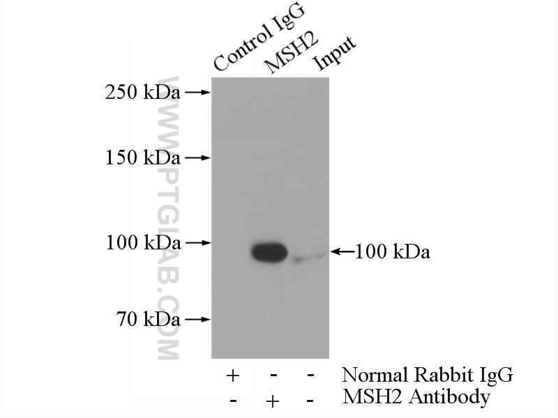 IP experiment of HeLa using 15520-1-AP