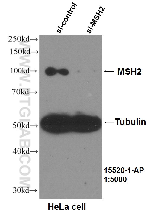 WB analysis of HeLa using 15520-1-AP