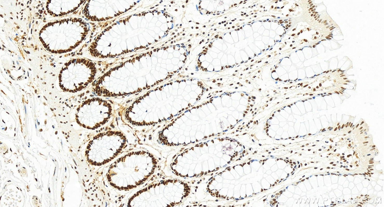 IHC staining of human colon using 82775-1-RR