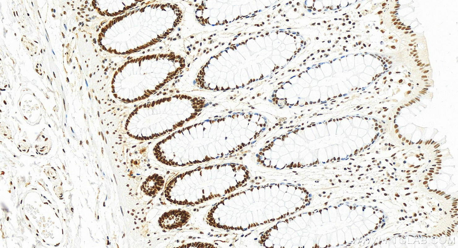 IHC staining of human colon using 82775-1-RR