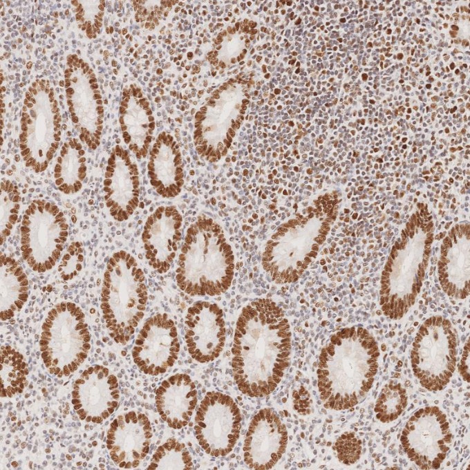 IHC staining of human appendicitis using 82775-1-RR