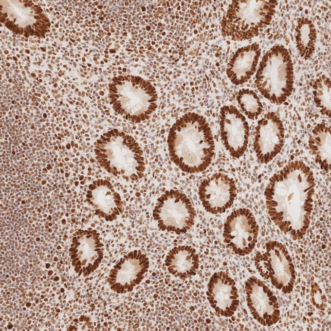 IHC staining of human appendicitis using 82775-1-RR