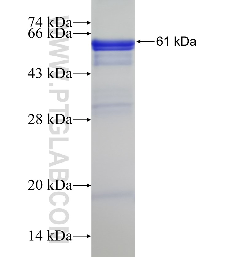 MSH2 fusion protein Ag7835 SDS-PAGE