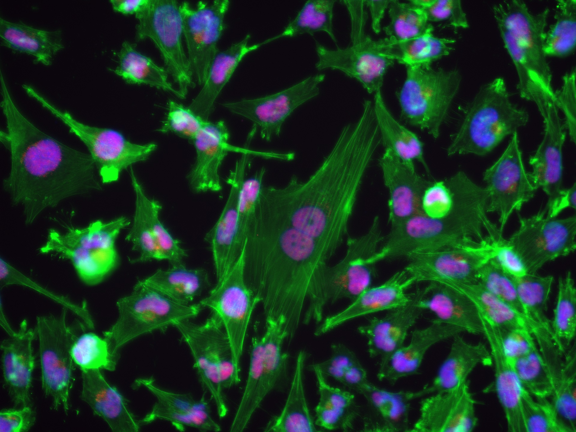 IF Staining of U-251 using 82845-3-RR