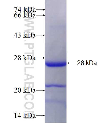 MSH5 fusion protein Ag28017 SDS-PAGE MSH5 fusion protein Ag28017 SDS-PAGE