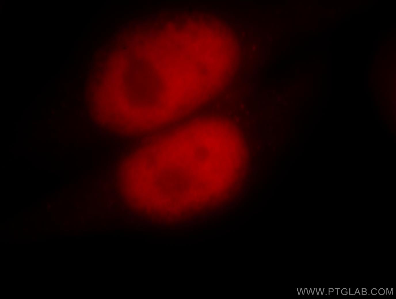 IF Staining of HeLa using 18120-1-AP