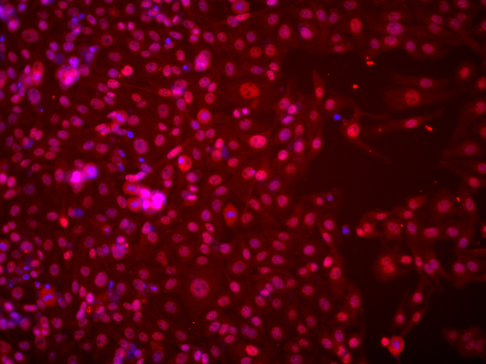 IF Staining of U2OS using 66172-1-Ig