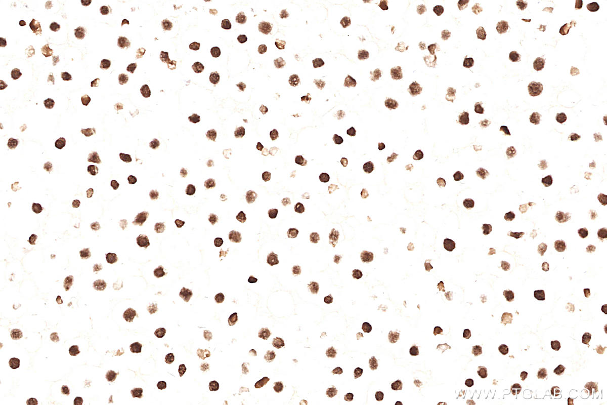 IHC staining of Ramos using 66172-1-Ig