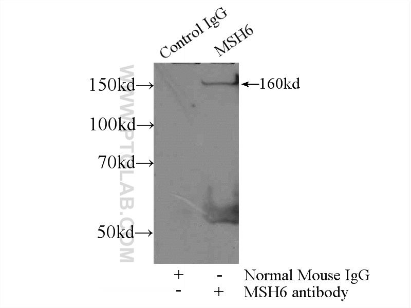 IP experiment of HEK-293 using 66172-1-Ig