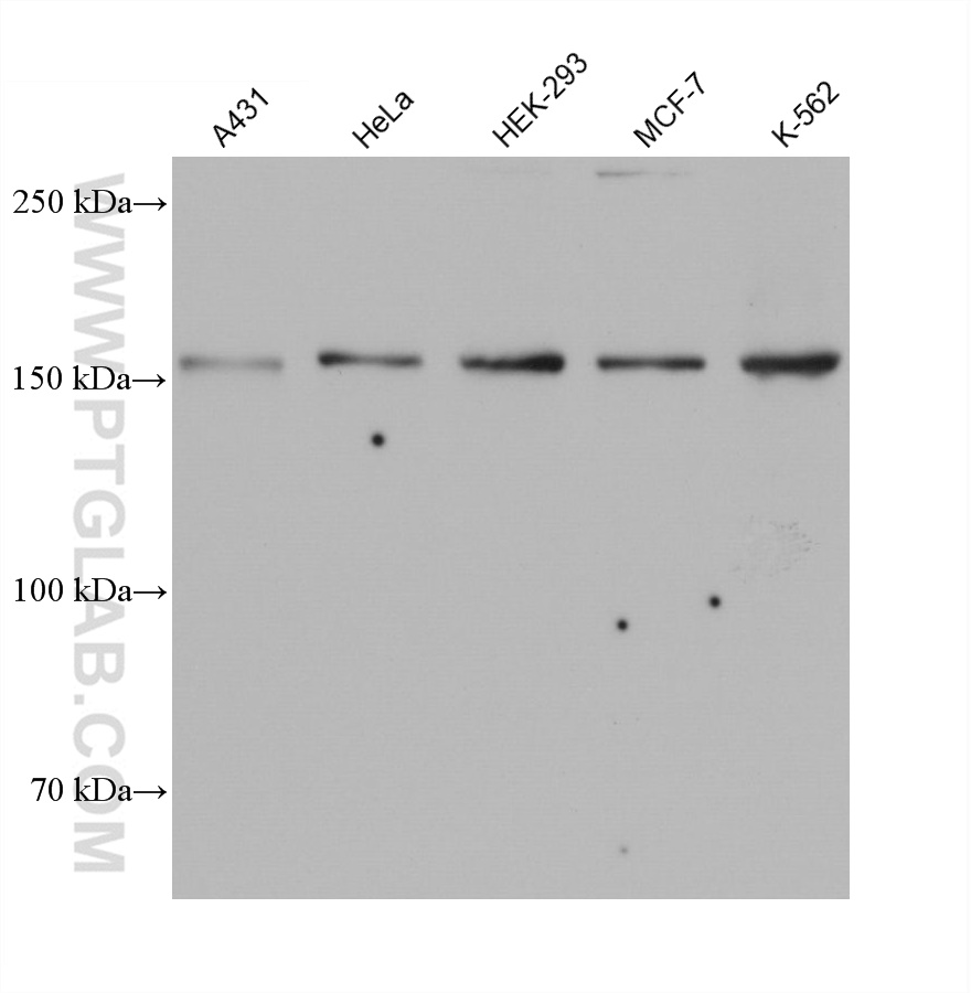 WB analysis using 66172-1-Ig