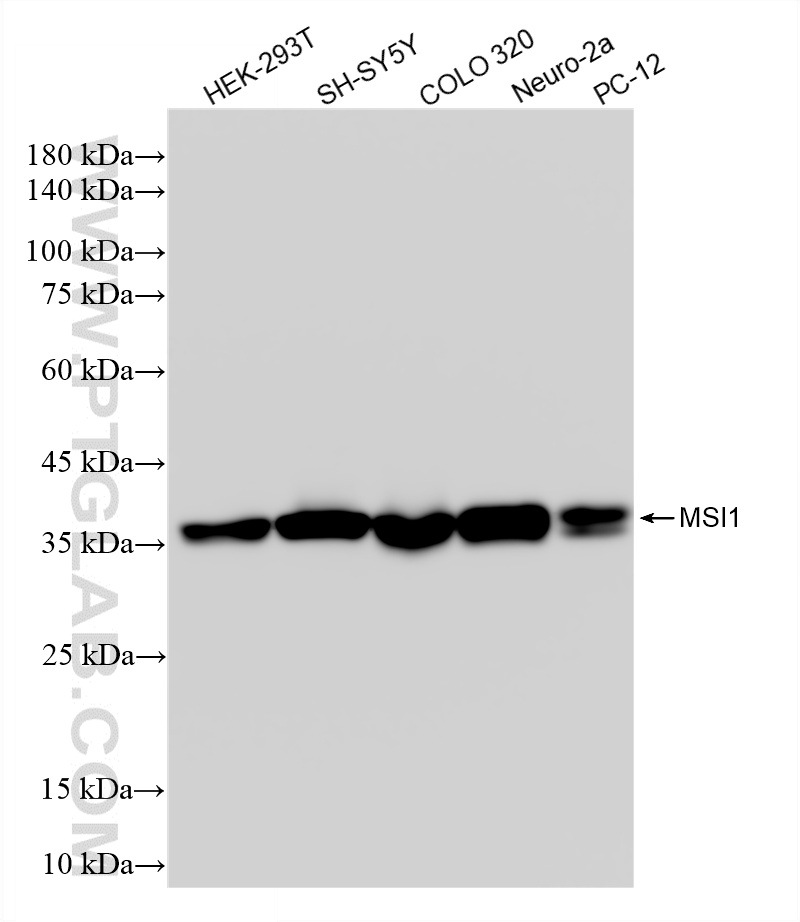 WB analysis using 86723-1-RR (same clone as 86723-1-PBS)