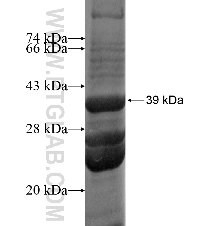 MSI1 fusion protein Ag16219 SDS-PAGE MSI1 fusion protein Ag16219 SDS-PAGE