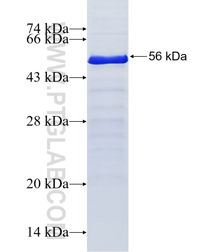 MSL1 fusion protein Ag19174 SDS-PAGE MSL1 fusion protein Ag19174 SDS-PAGE