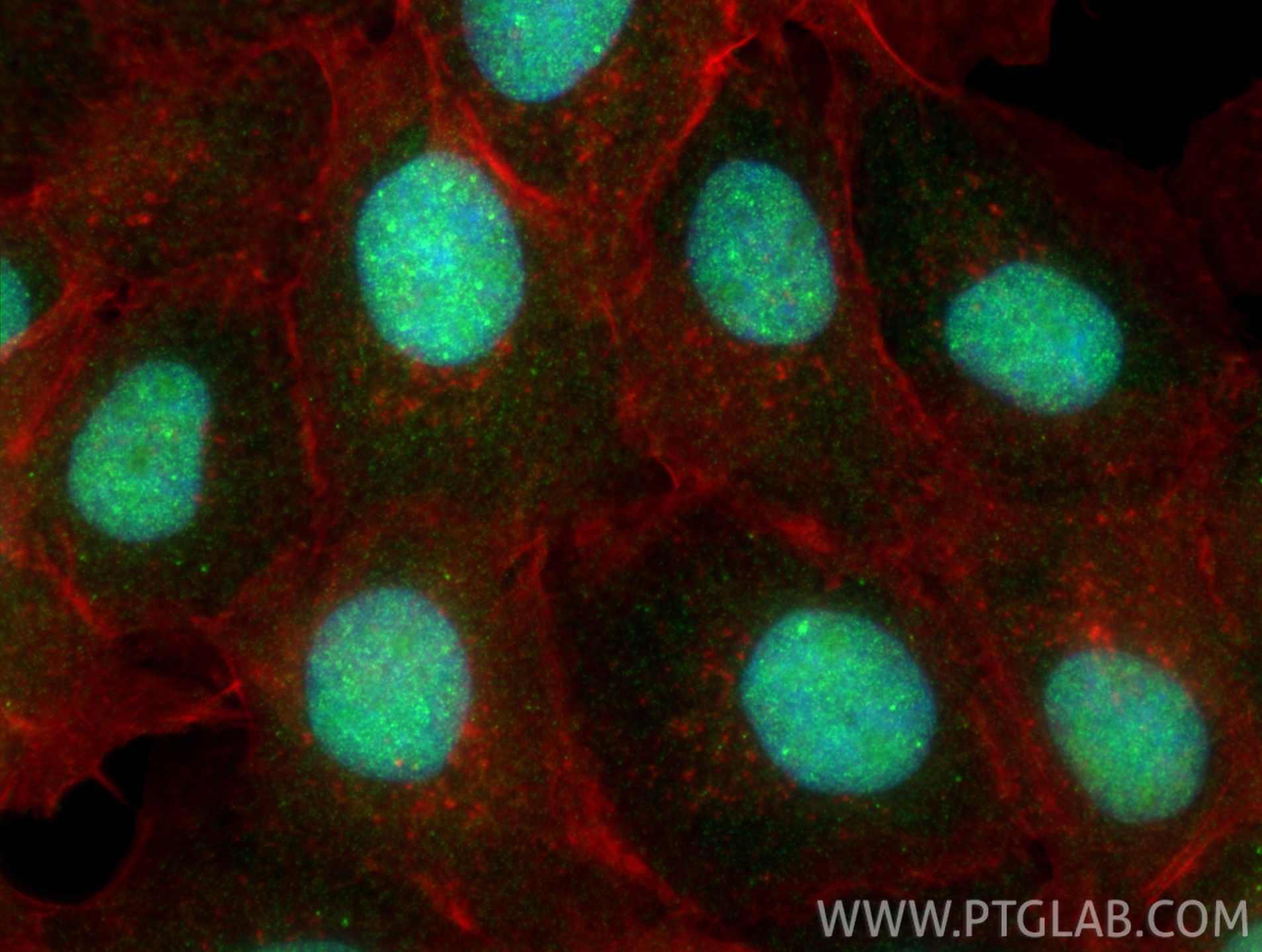 IF Staining of A431 using 23601-1-AP IF Staining of A431 using 23601-1-AP