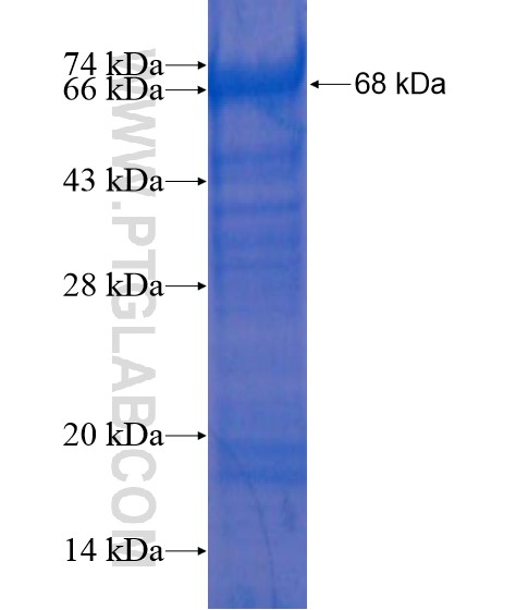 MSL2 fusion protein Ag18727 SDS-PAGE