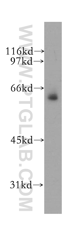 WB analysis of mouse skeletal muscle using 12977-1-AP