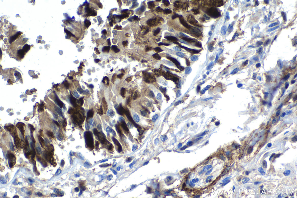 IHC staining of human lung using 15888-1-AP