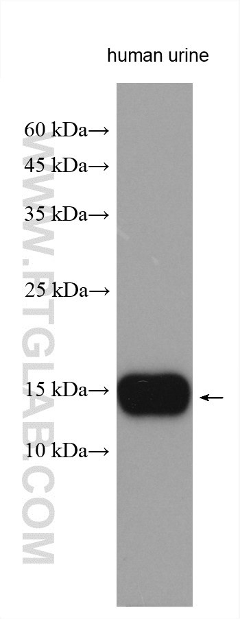 WB analysis using 15888-1-AP