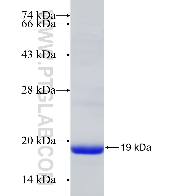MSMP fusion protein Ag31015 SDS-PAGE MSMP fusion protein Ag31015 SDS-PAGE