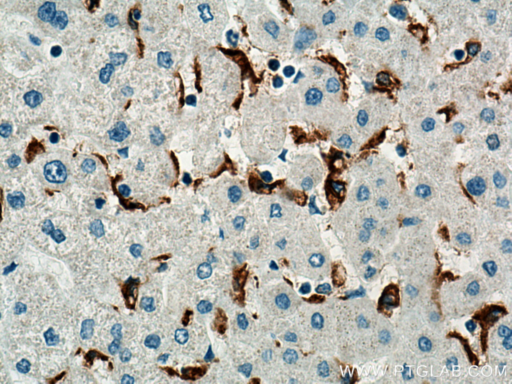 IHC staining of human liver using 17858-1-AP