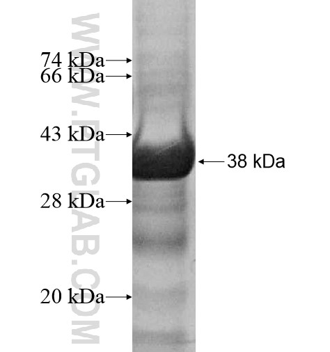 MSR1 fusion protein Ag12284 SDS-PAGE MSR1 fusion protein Ag12284 SDS-PAGE