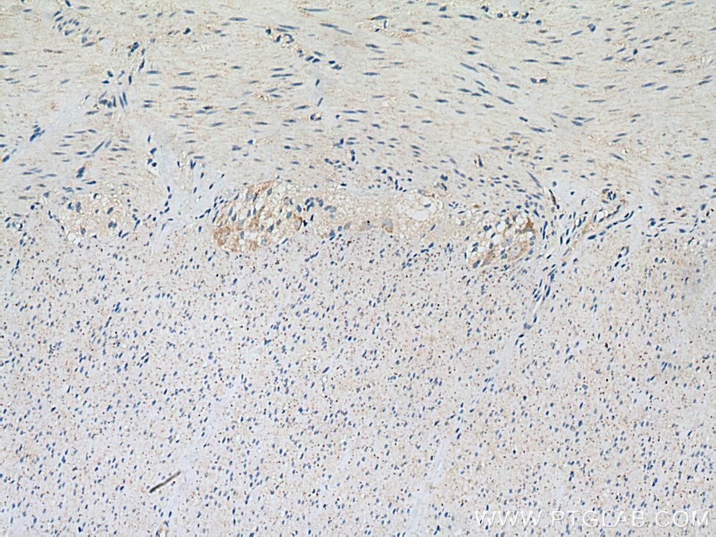 IHC staining of human colon using 14547-1-AP