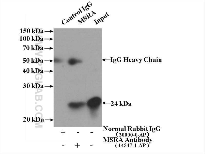 IP experiment of mouse kidney using 14547-1-AP